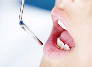 Cure odontoiatriche di base